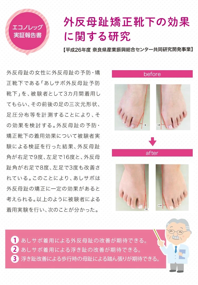 履くだけで足の指がラクにひらく靴下｜奈良産の高機能靴下専門店エコノレッグ