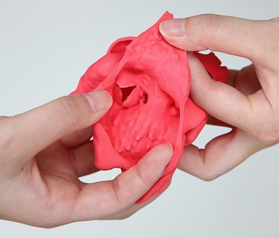 心室中隔欠損症モデル：VSD / 赤（XC-01CDc）_購入 | 株式会社